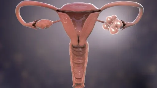 Hormonale aandoening die miljoenen vrouwen treft krijgt nieuwe naam