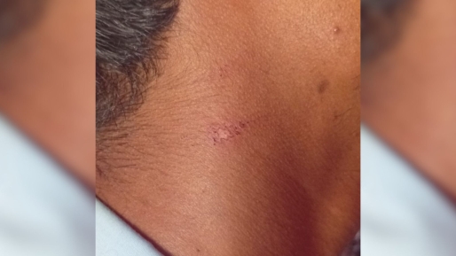 Minderjarige broers zeggen mishandeld te zijn door politie in Meerzorg